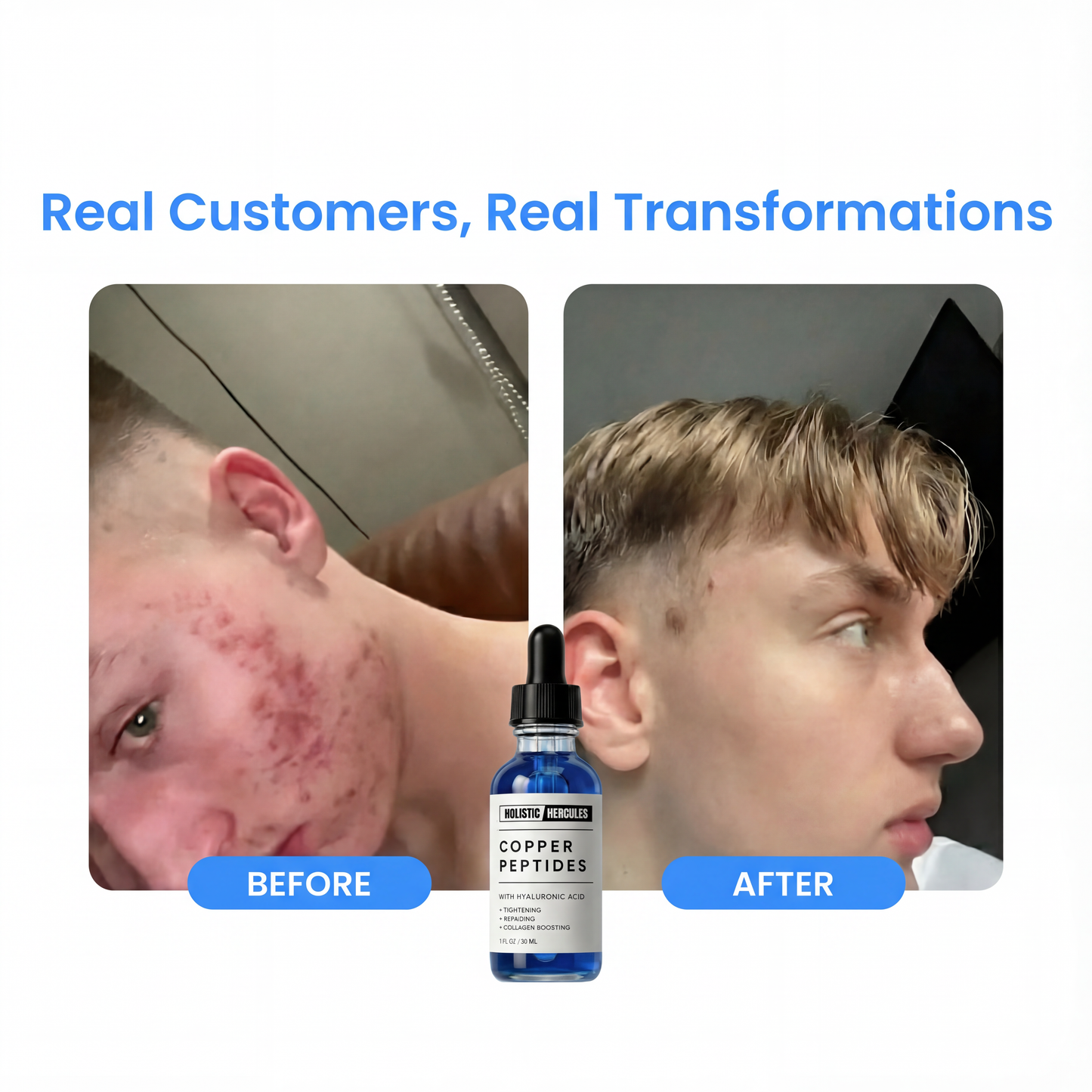 GHK-Cu Peptides Serum